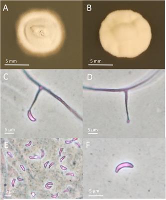 Large Scale Screening of Epichloë Endophytes Infecting Schedonorus pratensis and Other Forage Grasses Reveals a Relation Between Microsatellite-Based Haplotypes and Loline Alkaloid Levels